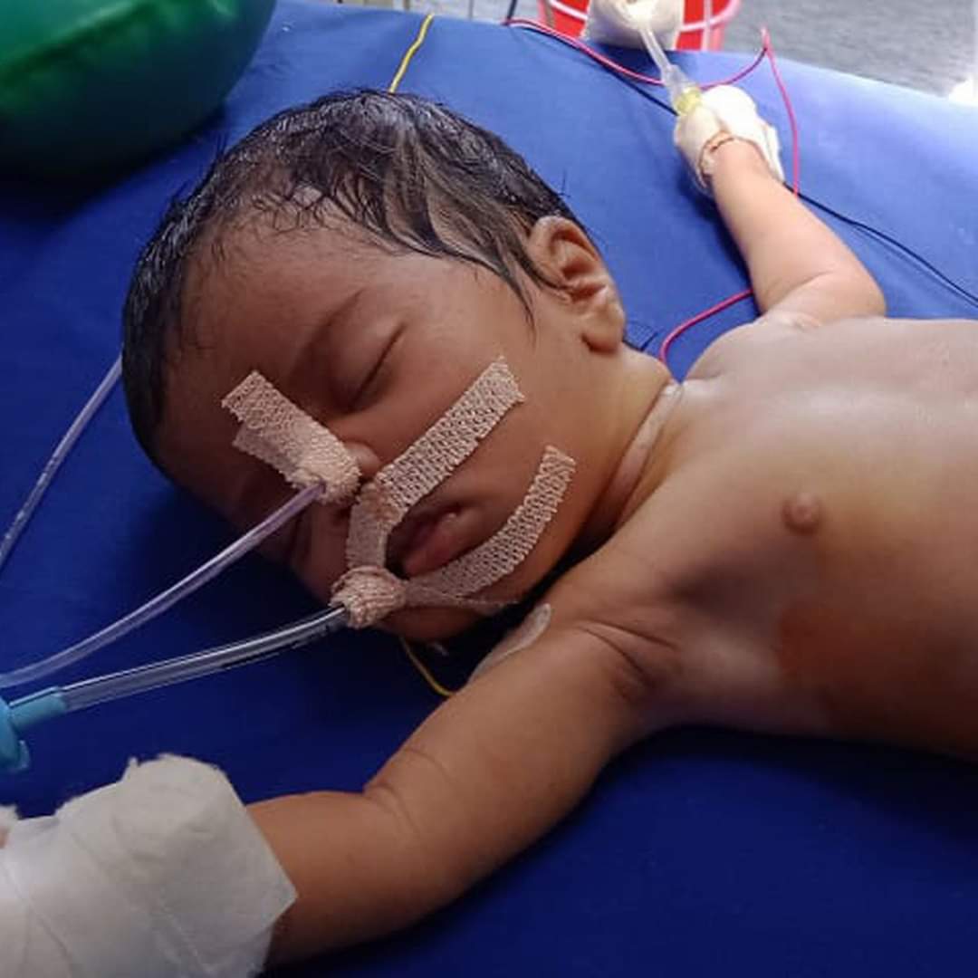 طفلة حديثة الولادة